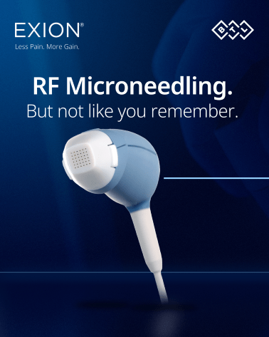 exion RF microneedling